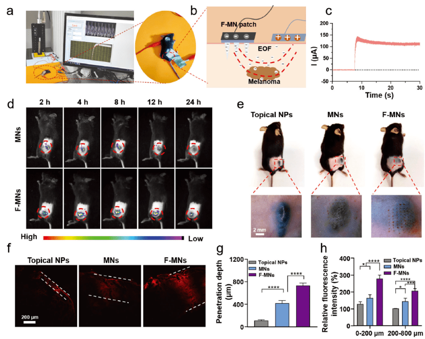 武大藥學院黎威教授課題組:可穿戴式自供電微針貼片用於增強深部黑