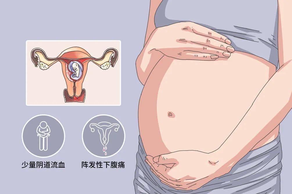 着床反应大_怀孕反应着床会出血吗_怀孕刚着床的6个反应