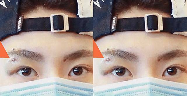 为了隐藏住自己的眉钉,小鬼在参加节目的时候,特地拿两个胶带贴到了