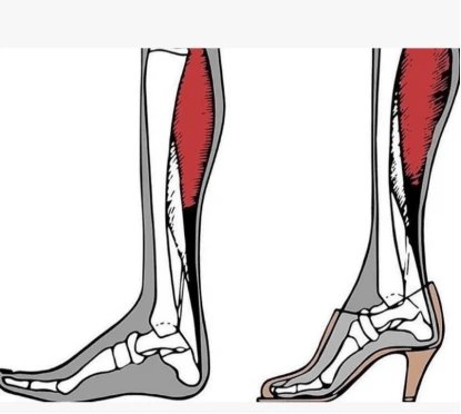 高跟鞋能天天穿吗?_膝关节_压力_不会影响