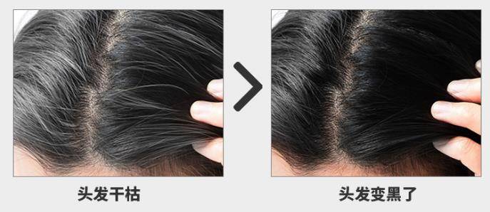 种头发大概要多少钱