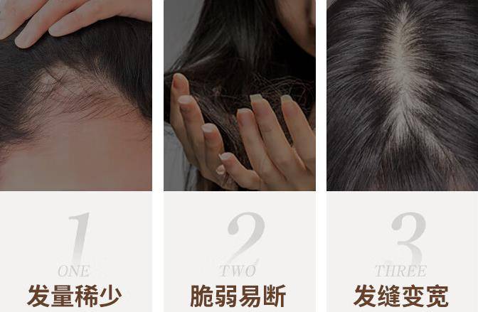 防脱育发洗发水真的有用吗?初阶养发技巧get!