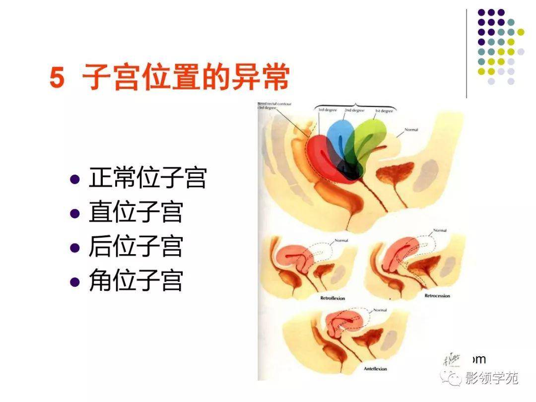 女性盆腔水平断面解剖