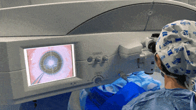 1元秒杀199元近视手术检查套餐,给你1080p高清视界!