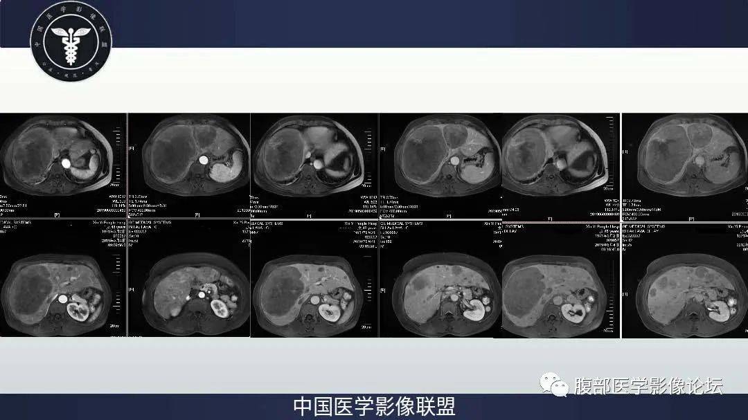 肾能症状功能好肝功能不好_肾功能及肝功能不好的症状_肾能症状功能好肝功能异常