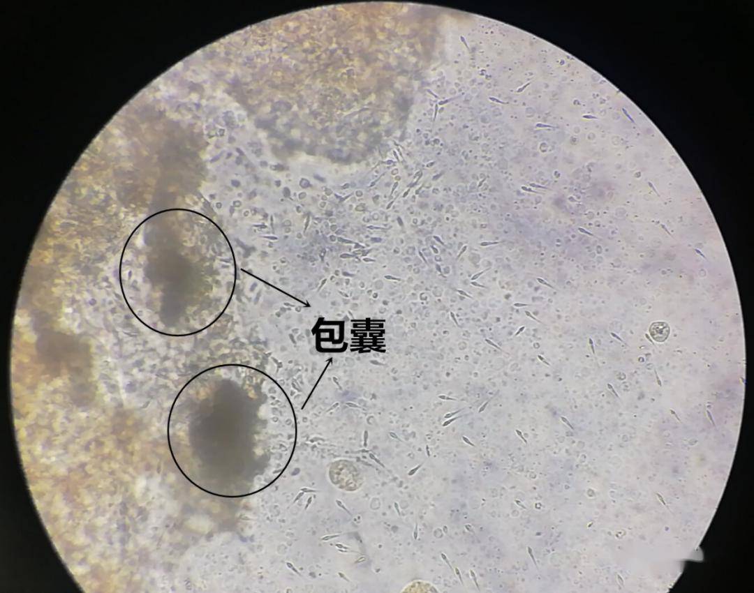 【每周一例】尾孢子虫引起斑点叉尾鮰烂鳃,死亡