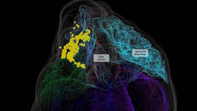 人類首次心臟神經元的3d圖面世為攻克心臟疾病創造了無限可能