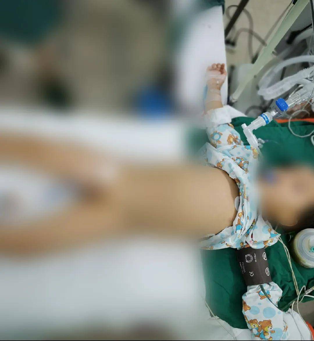 恐怖4岁男童饭后做了这个动作150厘米小肠被切除