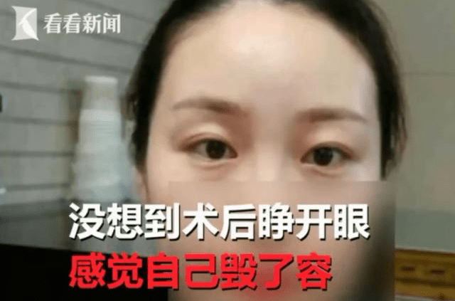 女子整容失败 眼皮割得比眼睛都宽 整容医院 化妆遮遮就好了 张女士