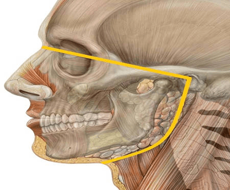 只有一排牙齿不齐,可以只戴一排牙套吗?