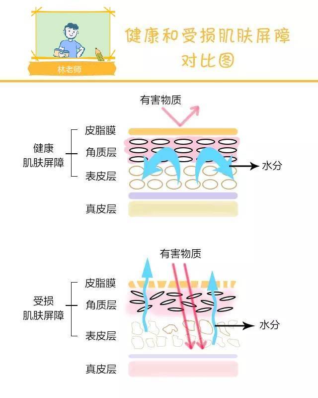 油脂阿澈护肤管家：痘痘不及时护理？小心秒变痘痘肌！