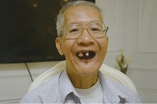 老年人为什么会牙齿都掉光?