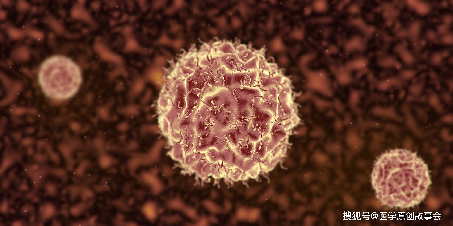 原创晚期癌症只能活活痛死癌症根本不用治肿瘤主任讲了四个真相