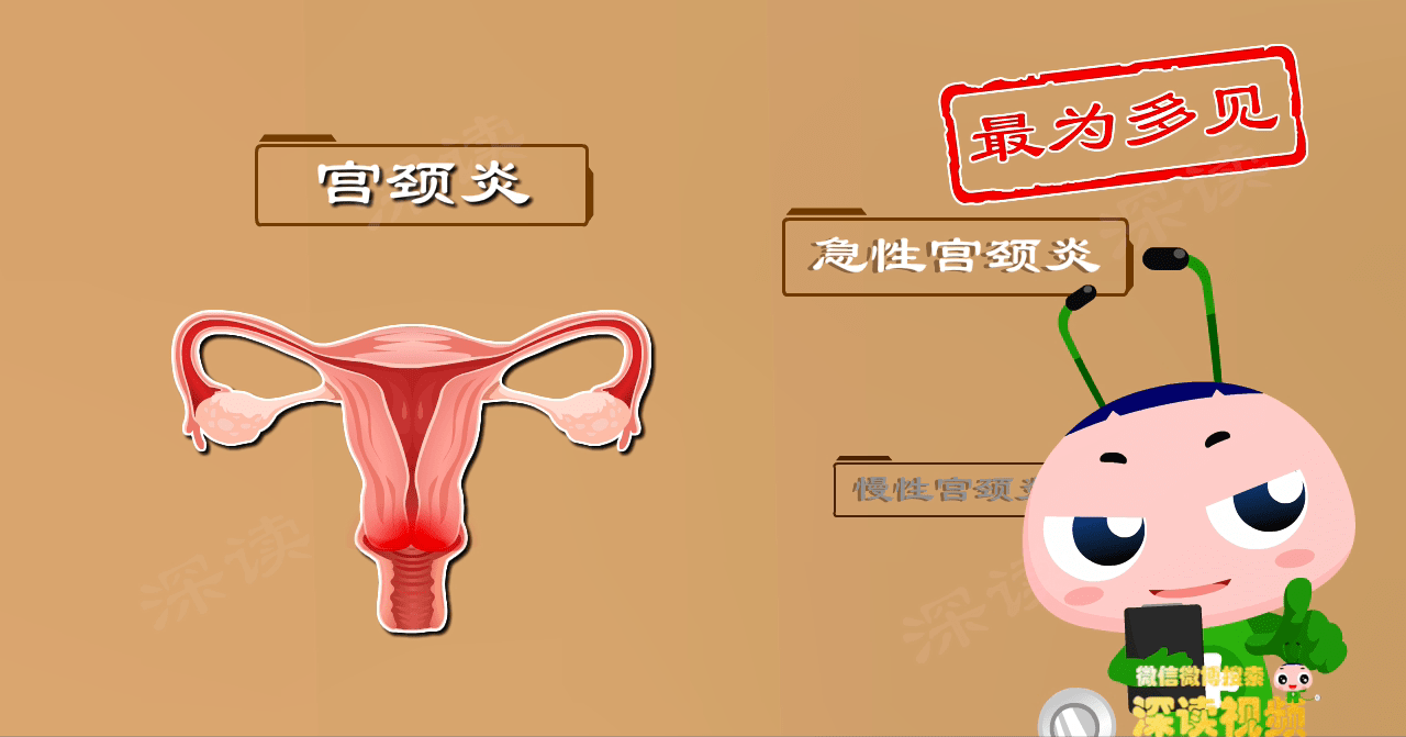原创
            40%的妇女患有宫颈炎？会致盆腔炎甚至不孕？除了白带增多还有啥症状？
                
                 