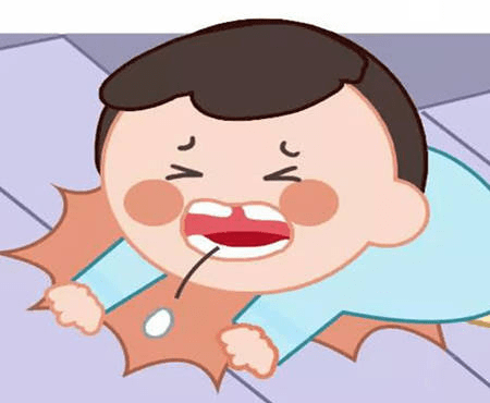 这很有可能会殃及宝宝的小乳牙,发生我们所说的牙外伤