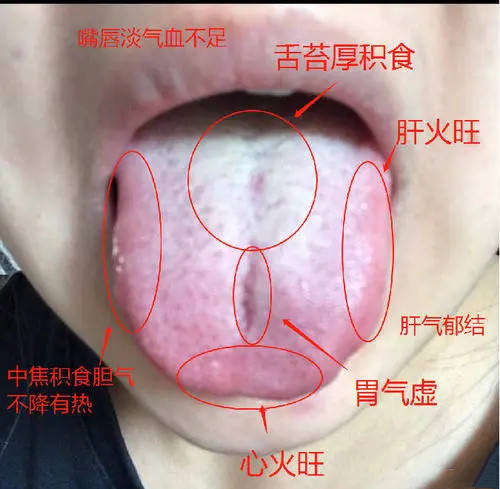 肝不好的舌头图图片