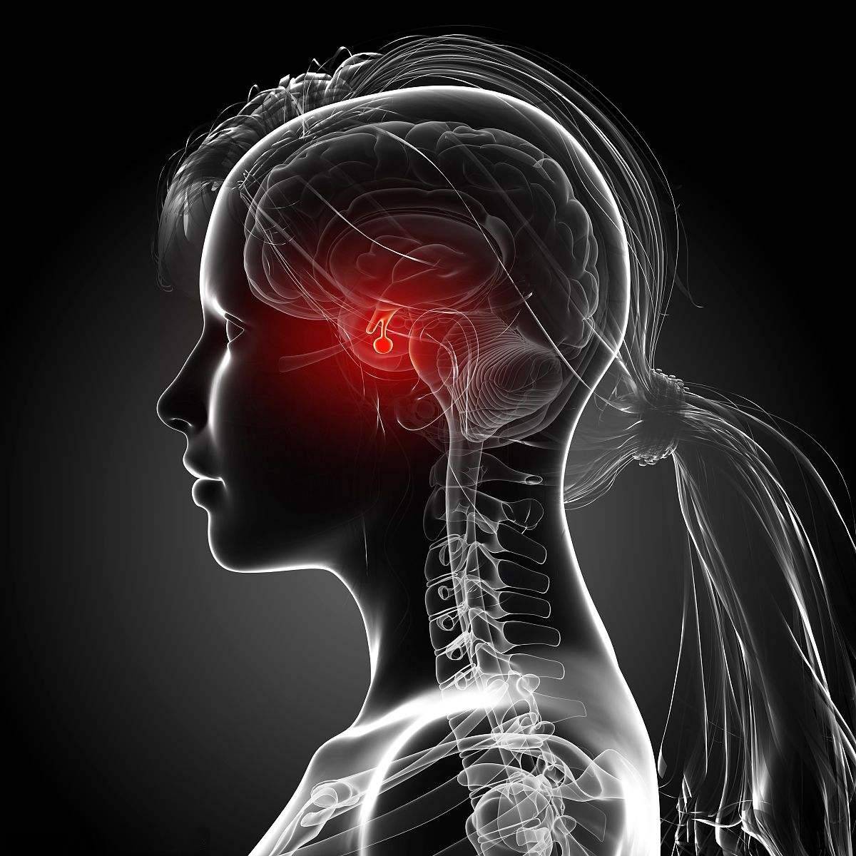 疾病科普不同类型垂体瘤的临床症状及诊断