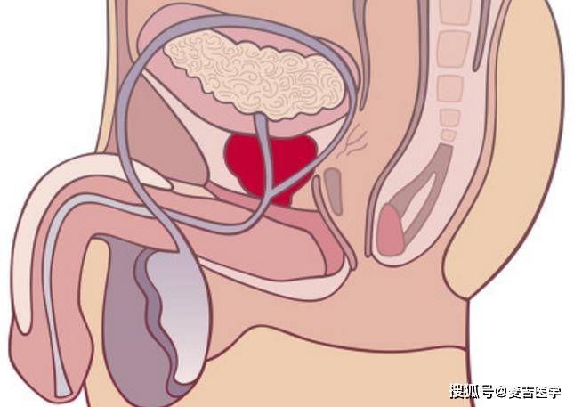 男性前列腺