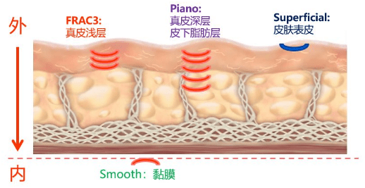 三维|拯救你不完美的下颌线，试试这个办法！