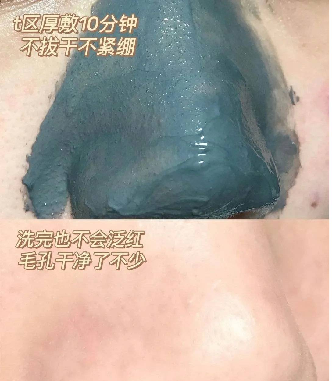 黑头|挖到宝藏泥膜了，简直就是毛孔吸尘器!!