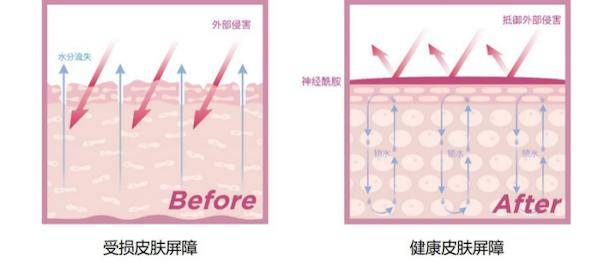 因为|脸上干燥起皮怎么解决？关于敏感肌的4个深度问答，必须收藏！