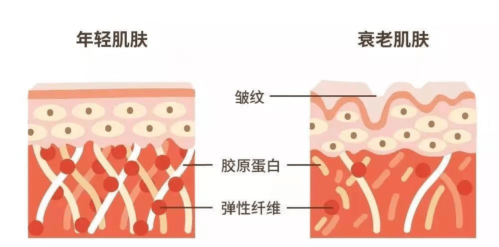 毛孔|毛孔粗大的姐妹们莫慌！你还有救!