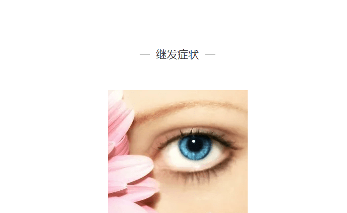 症状|卢老大课堂:出现睁眼困难、眼睑下垂谨慎—眼肌型重症肌无力!