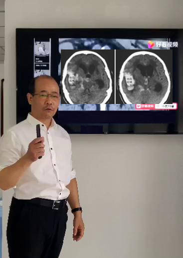 上肢|偏瘫患者的日常康复训练手法图解