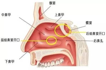 鼻窦炎位置图片图片