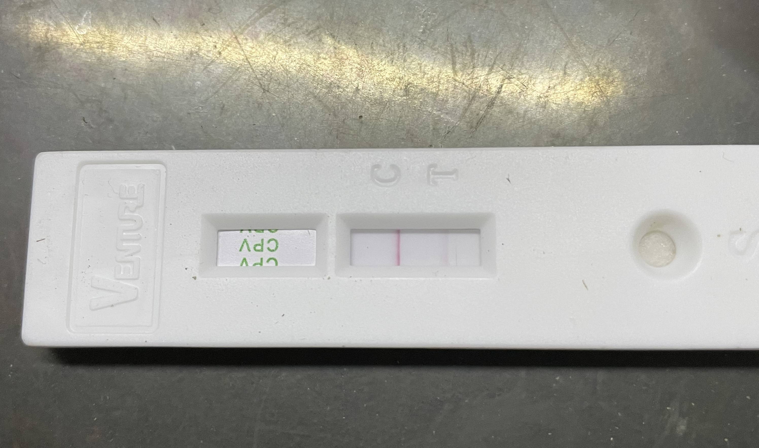 怎么确诊犬细小病毒还是肠炎?