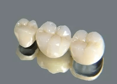 其实牙齿冠桥修复跟全瓷牙冠差不多,但是不一样的是,需要两端有两个