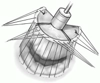 治疗|反复发烧2个多月，17岁女孩患的这种少见病经高难手术精巧治愈