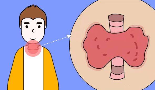 怎么样自己检查甲状腺 013ff8f23be34639938857a99540cfe6.jpeg