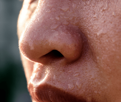 鼻子出汗:肺气不足表现:头部出汗比较多,恶寒发热,小便不顺畅,舌苔黄