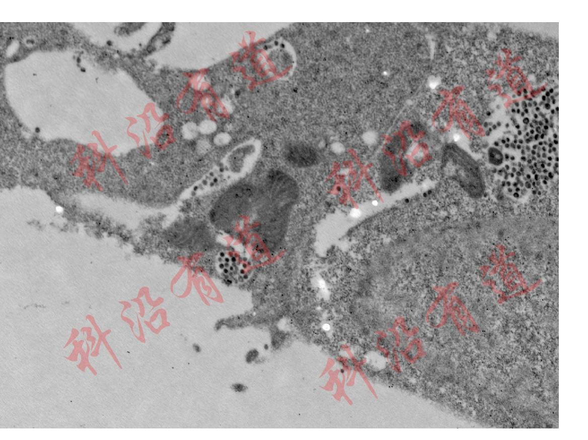 免疫电镜技术简介及样本准备注意事项