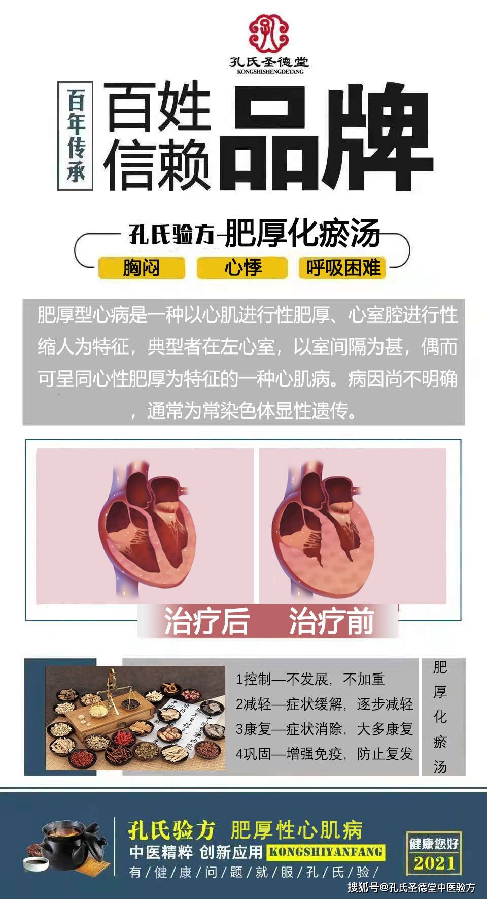 症状|肥厚性心肌病的病因有哪些？如何治疗？