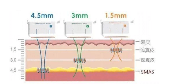 观点评论抗衰项目热门分析7D和超声刀哪个效果好?