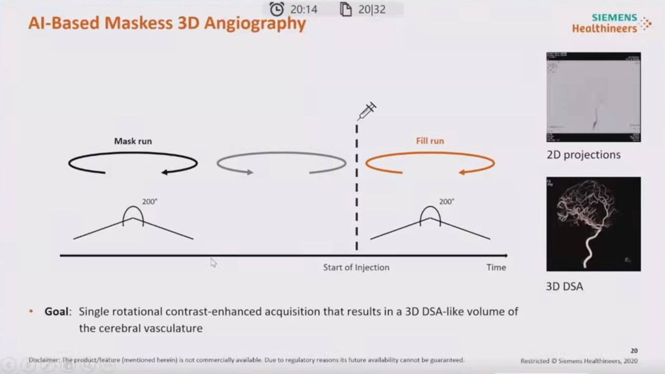 降低|神经介入领域新技术展望