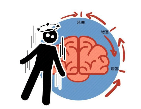 治疗|脑梗后遗症怎么办？这些一定要注意！福州国德康复医院