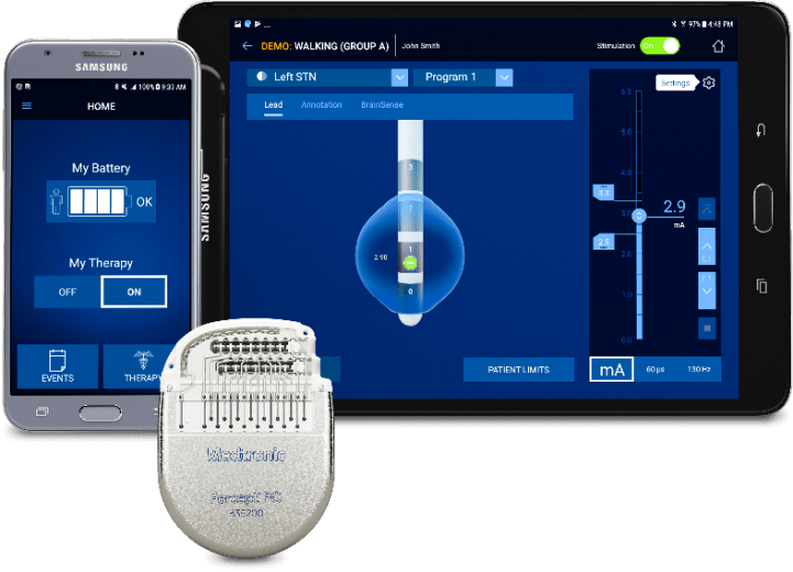 2021进博会全球首款具备感知技术的脑起搏器亮相进博会预计明年在中国