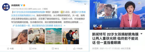 媒体|21岁女孩去世前指眼睛想捐角膜 武汉普瑞眼科角膜移植助2人获光明
