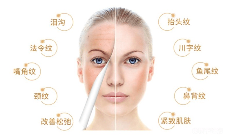 能量干细胞填充面部好不好、脸上打完干细胞注意事项有知道的吗？