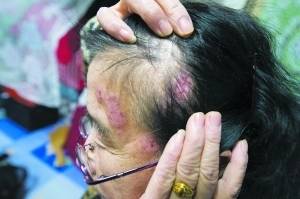 怎么能让头发毛囊再生 ab5eacbb27a340a282742925da099cfb.jpeg