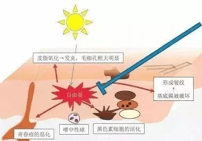 后天那些天生皮肤黑的人，后来是怎么变白的？