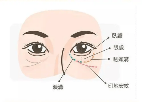 时间印第安纹是哪里？Summerccici老师告诉你