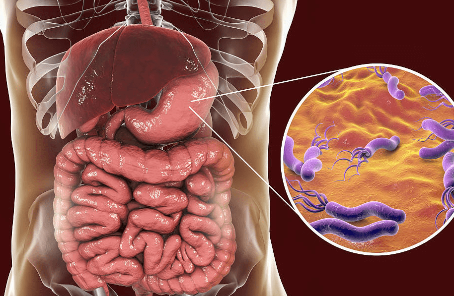 幽門螺桿菌進入身體後會對腸胃黏膜帶來損傷,減慢胃腸道蠕動速度,不能