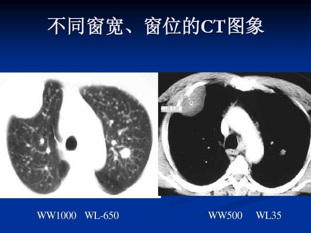 射线科普或许你不了解但他早已看穿一切