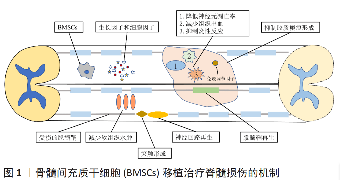 三则案例证实:干细胞移植对脊髓损伤的六大作用机制,有助于提高患者
