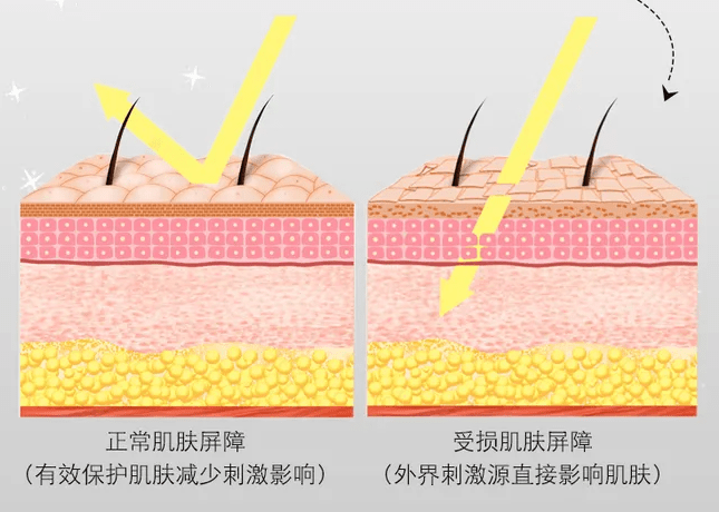 治疗叮~科普课堂已上线|敏感肌真的无缘医美??你想了解的都在这儿!