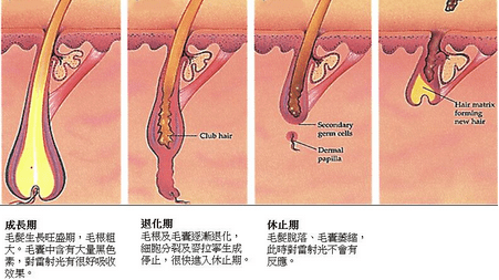 雄性激素脱发人群应该怎么做?